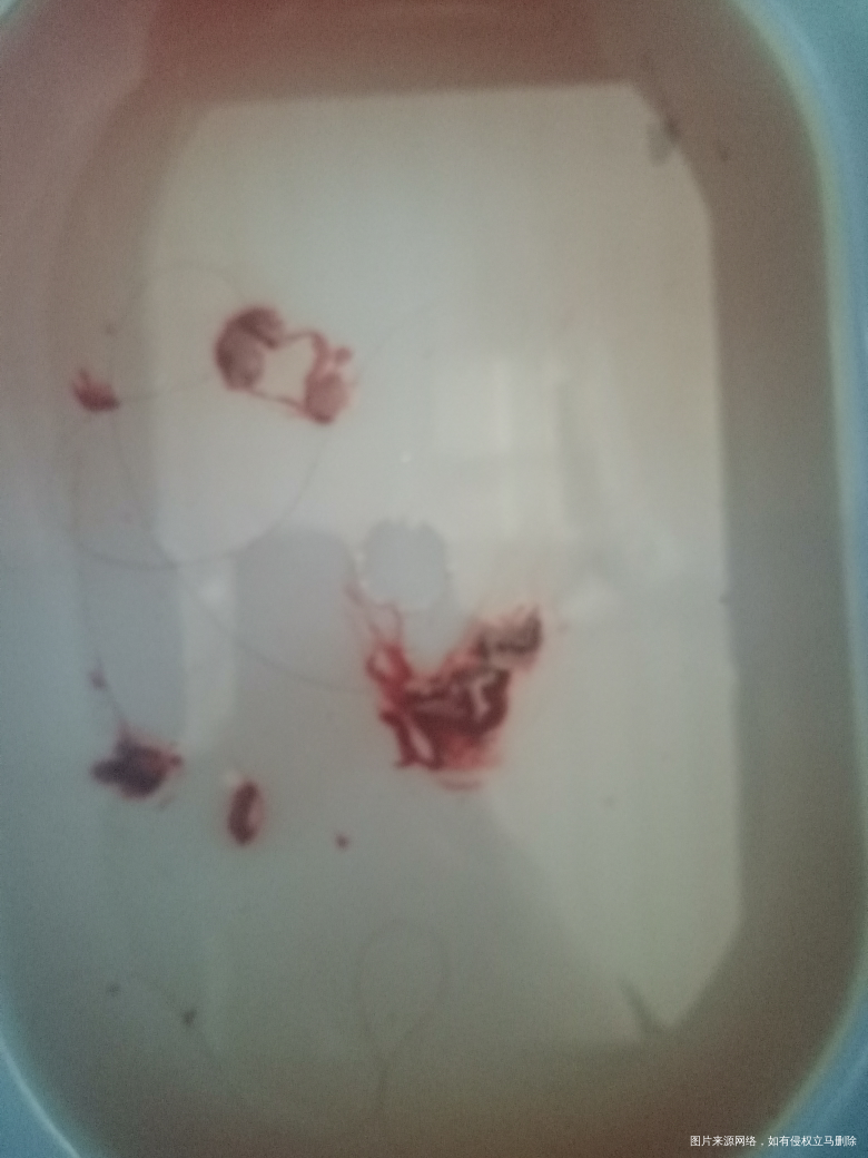 请医生给我点信心吧,看看我还有希望吗