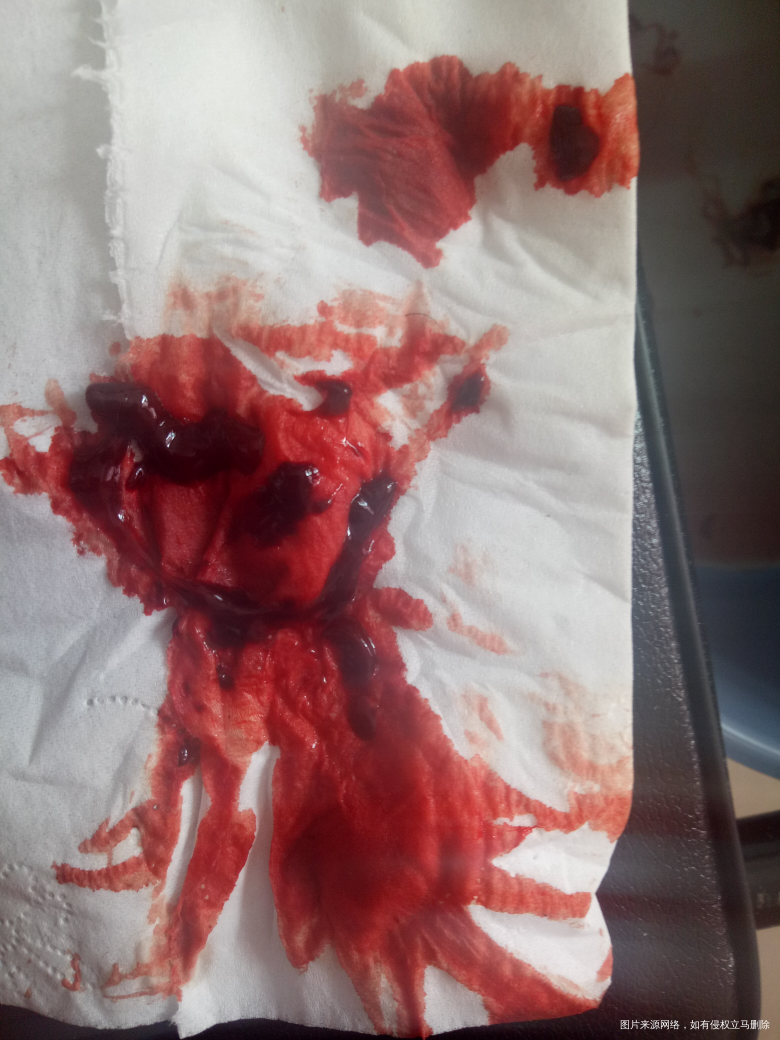 请医生给我点信心吧,看看我还有希望吗