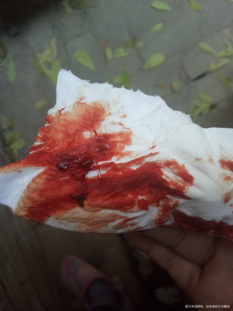 请医生给我点信心吧,看看我还有希望吗