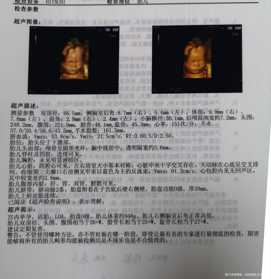 25+5做的四维,请帮忙看看