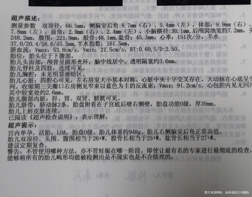 孕31周右侧后脑室增宽