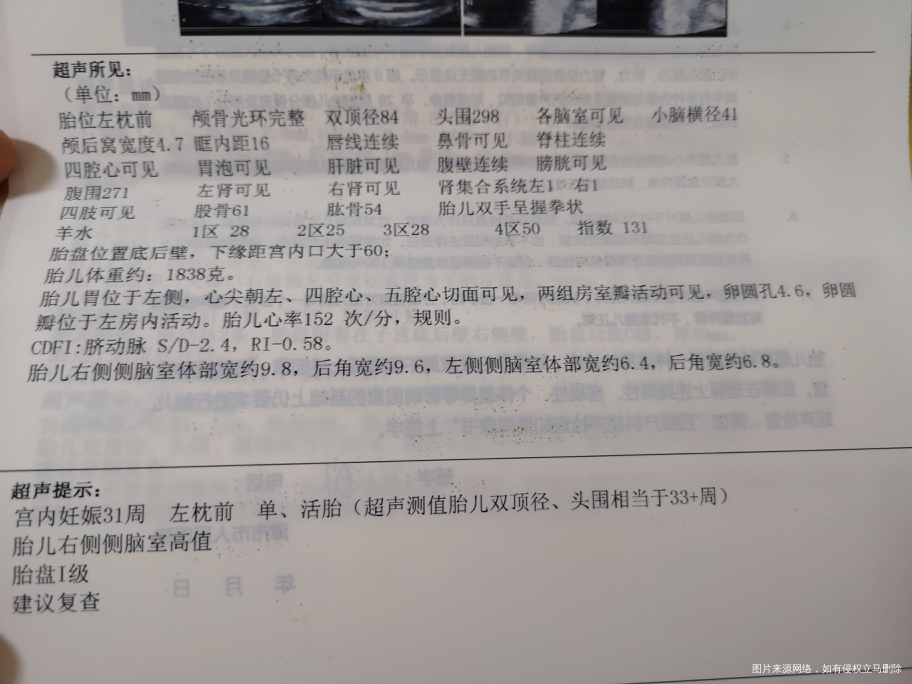 孕31周右侧后脑室增宽