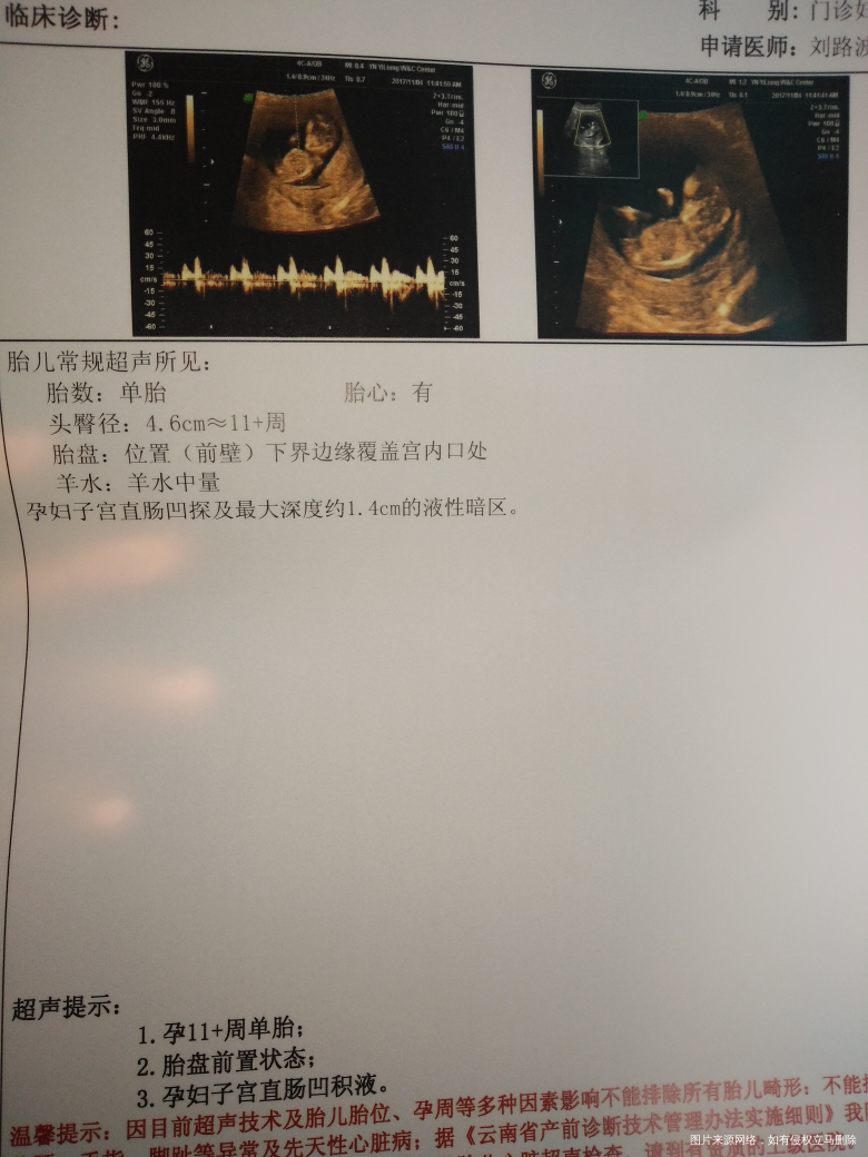 麻烦医生帮忙看看今天建卡做的B超