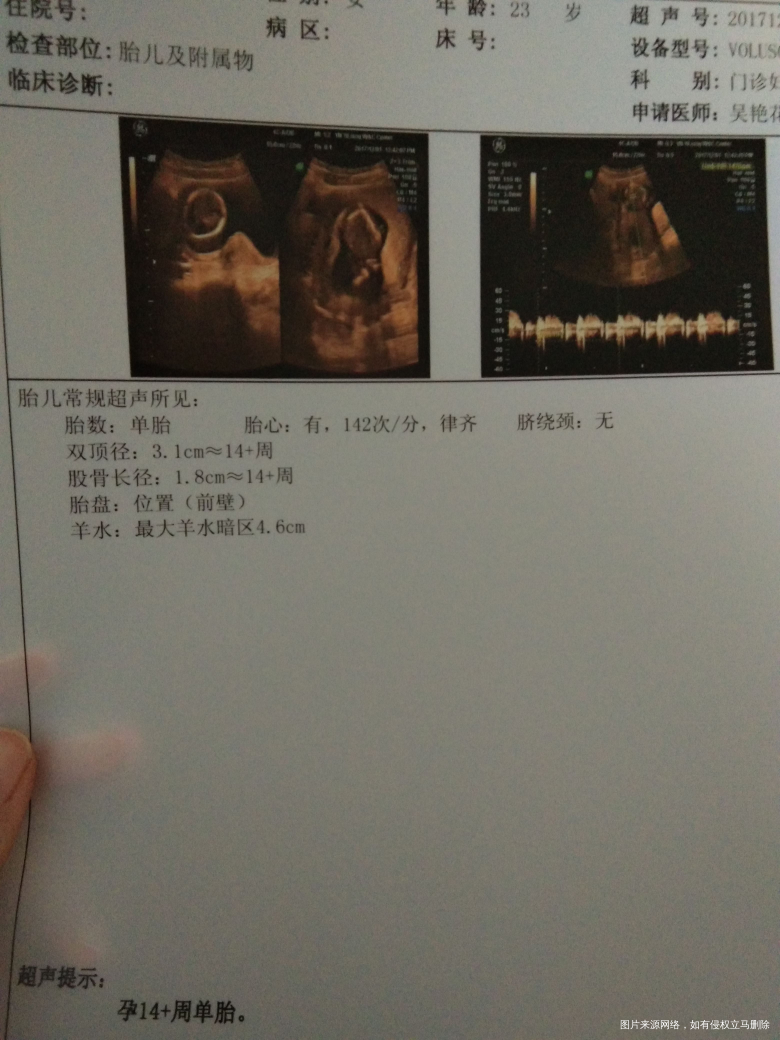 麻烦医生帮我看看凑字凑字