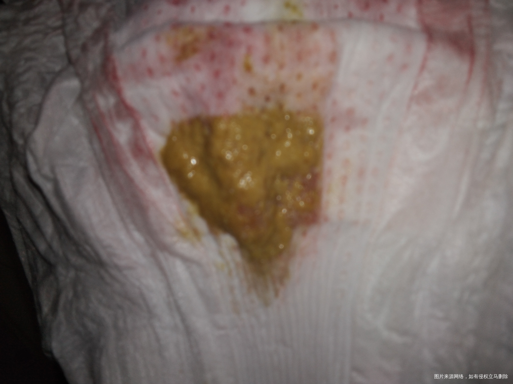 麻烦医生看看,焦急,急人