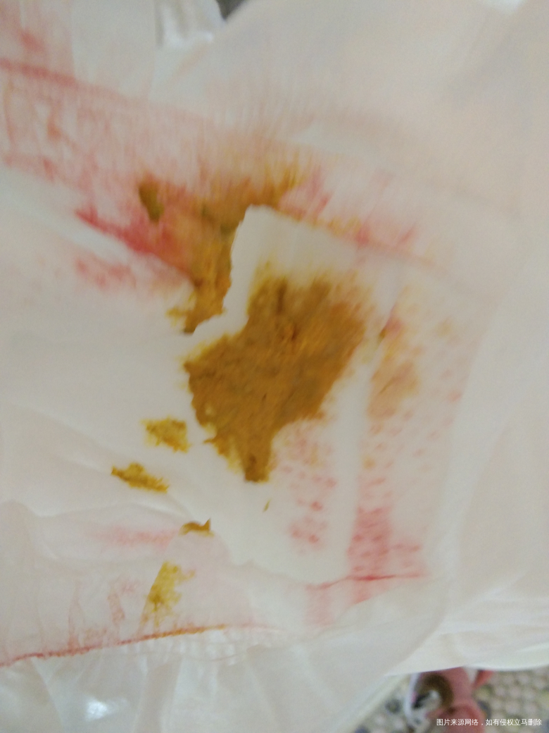 麻烦医生看看,焦急,急人