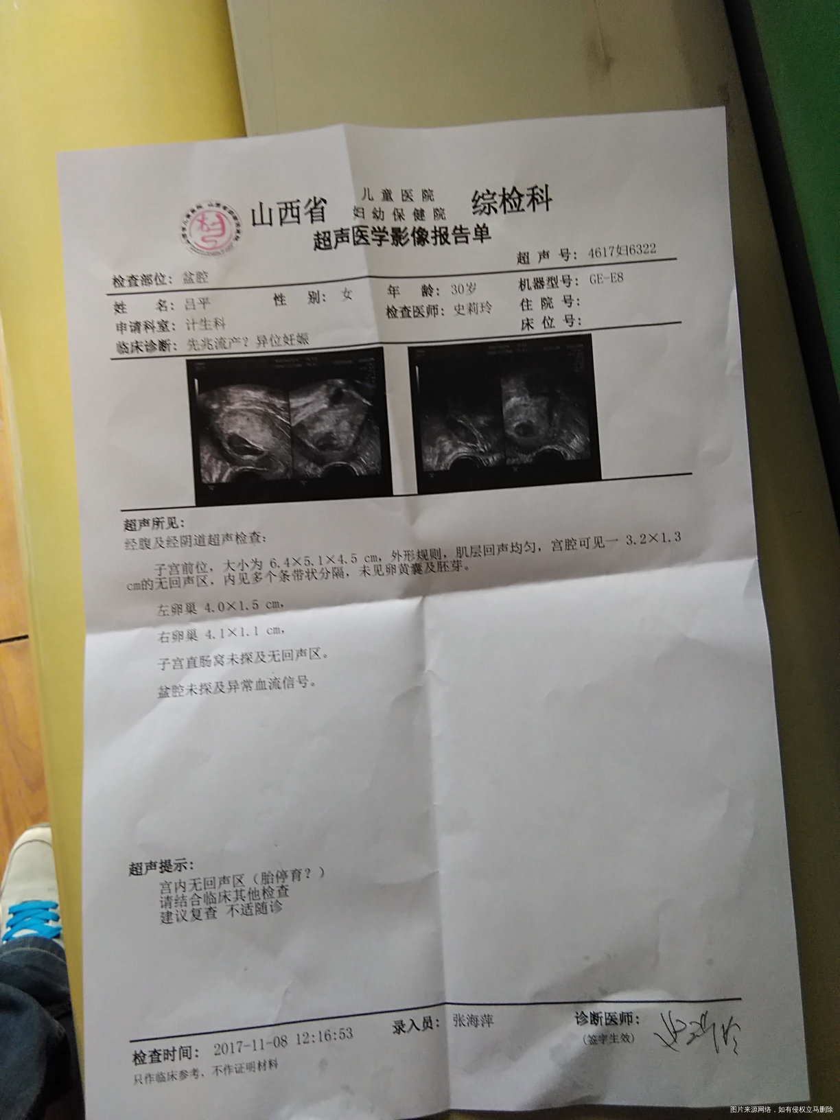 大夫帮我看看检查结果