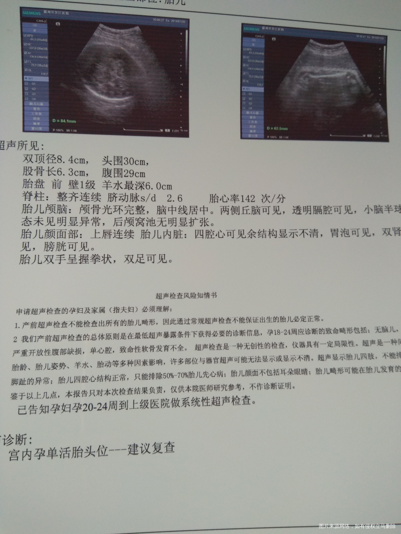 宝宝34+3了,胎儿内脏检查总是四腔心可见,