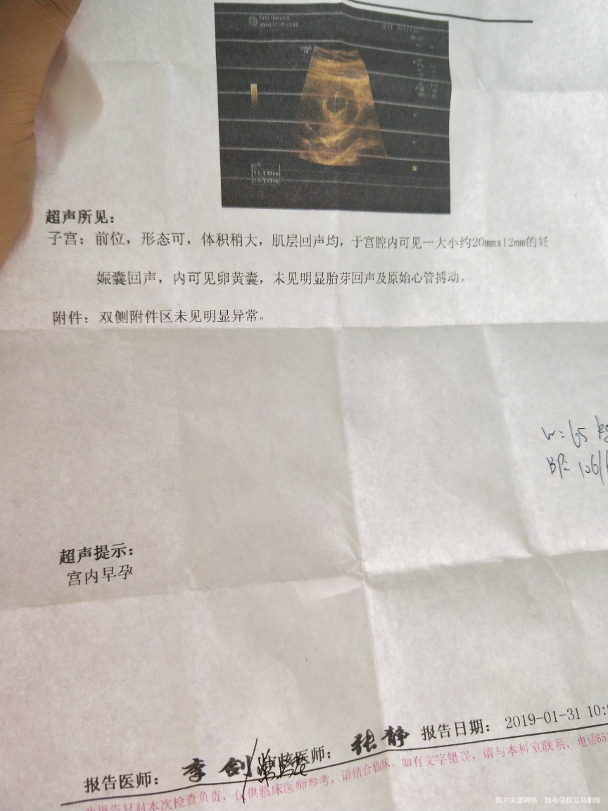 会有胎心吗,好害怕,帮忙看看