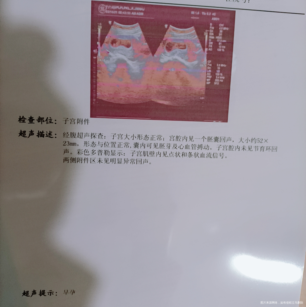 大宝女孩,这是意外来的二宝,不是重男轻女,我想拼个好字
