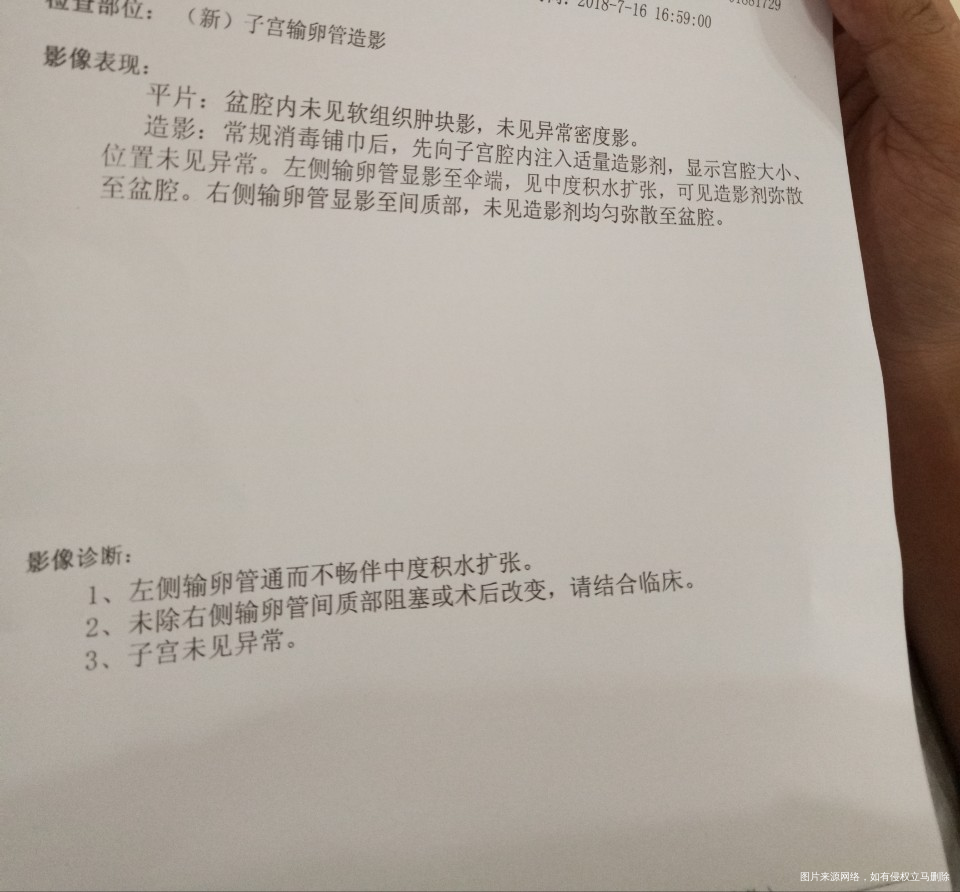 请问医生,我这个严重吗?