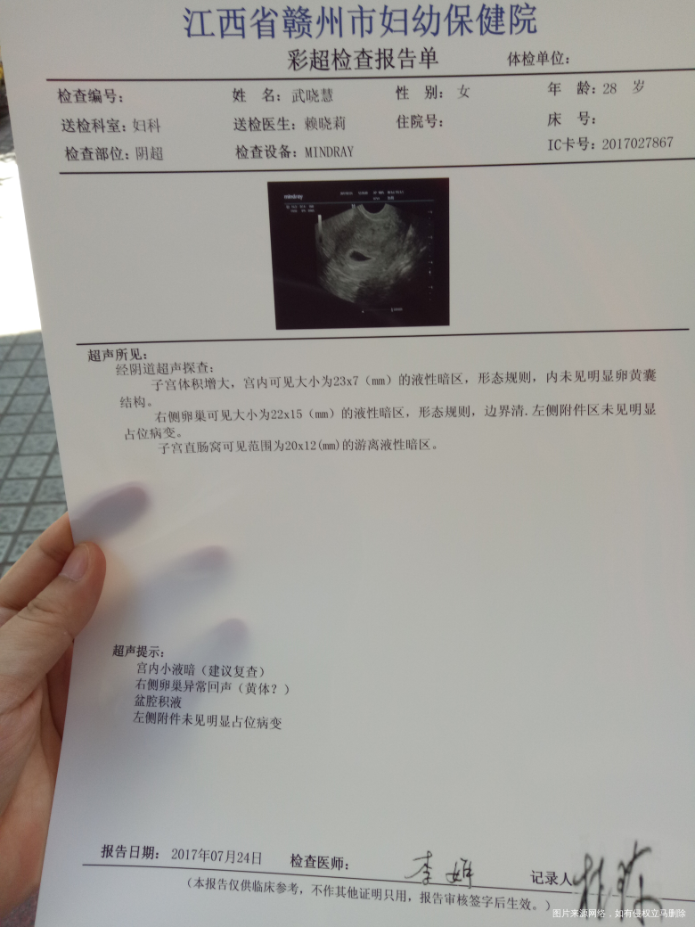 请帮我分析一下这是什么意思