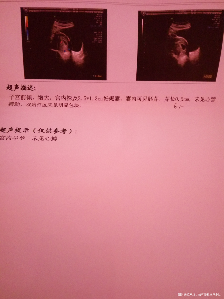 大家看看孩子还保的住吗?我很害怕