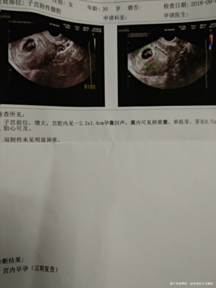 我怀啦 | 好孕51天bc归来,热乎胎心