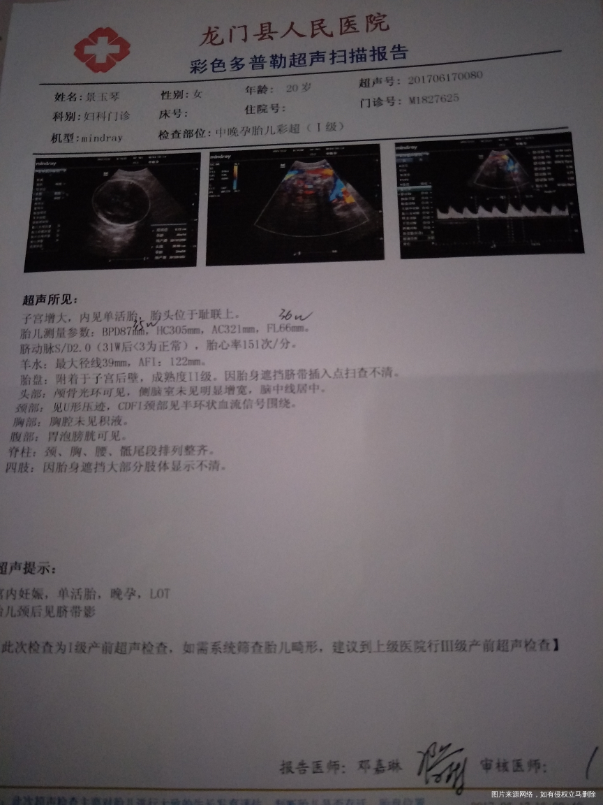 麻烦医生看看这张b超多少周了
