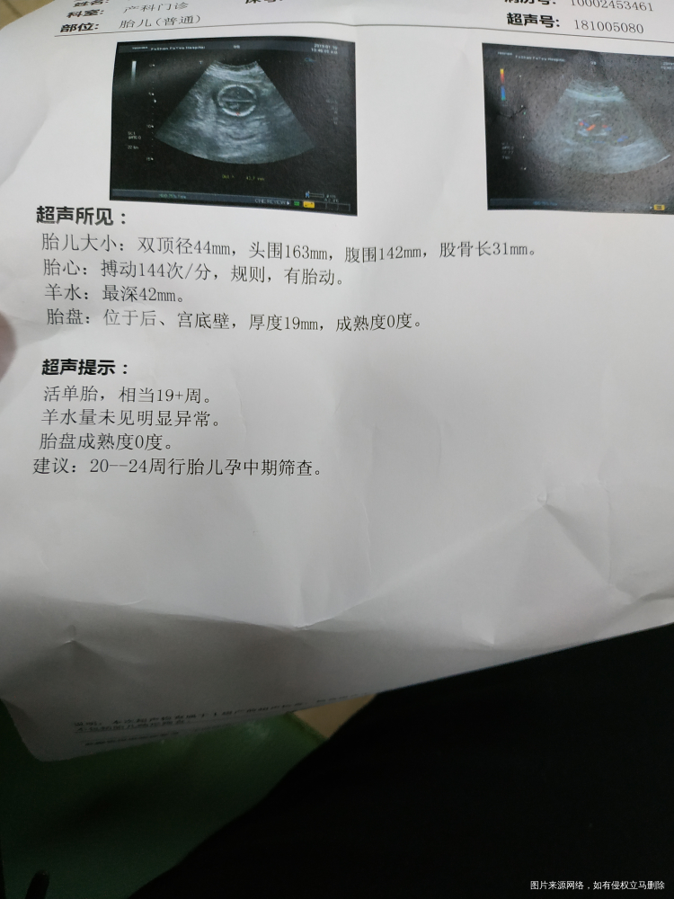 请医生帮我看看。正常吗?