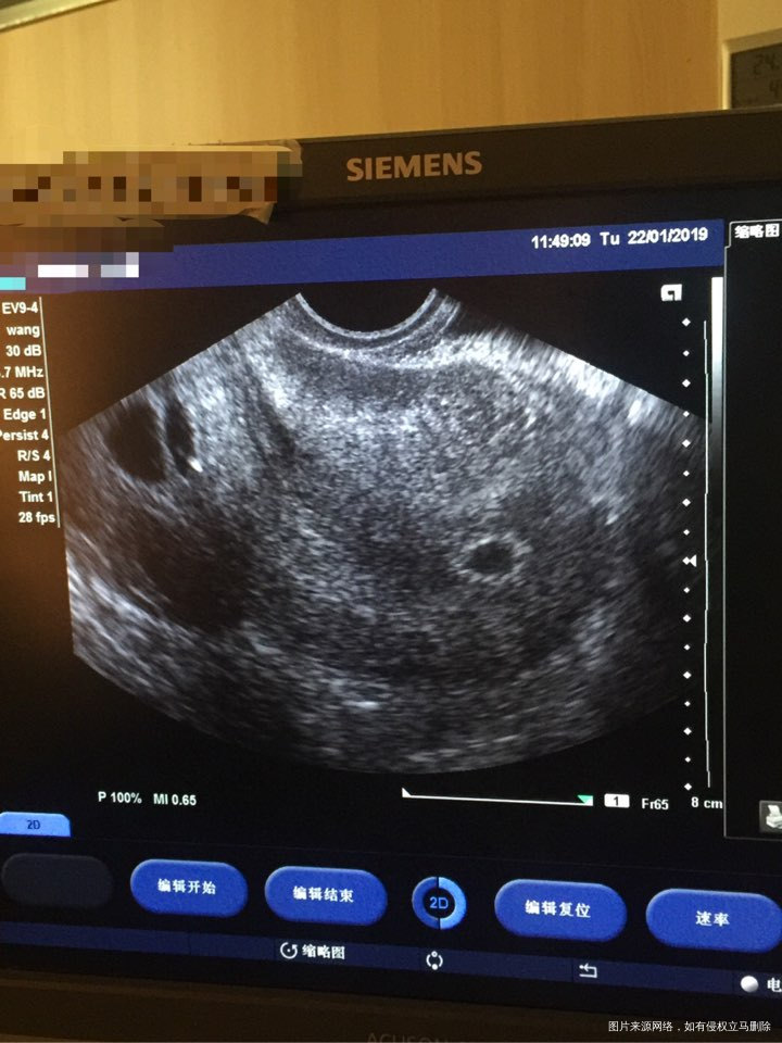 医生帮我看看还有没有希望?