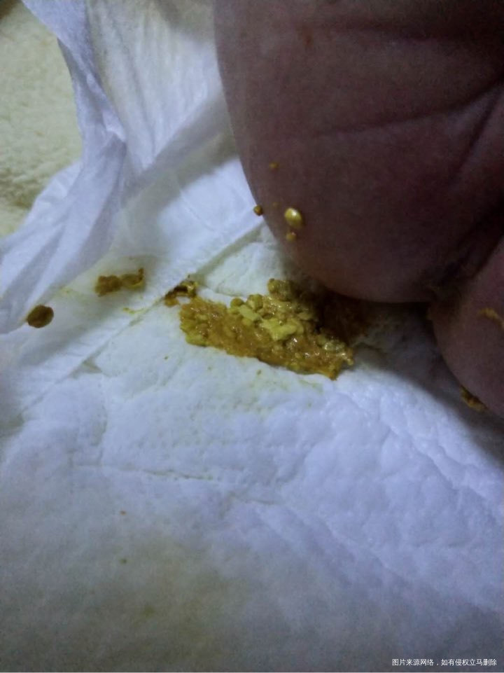 新生妈妈,麻烦哪位医生帮忙下