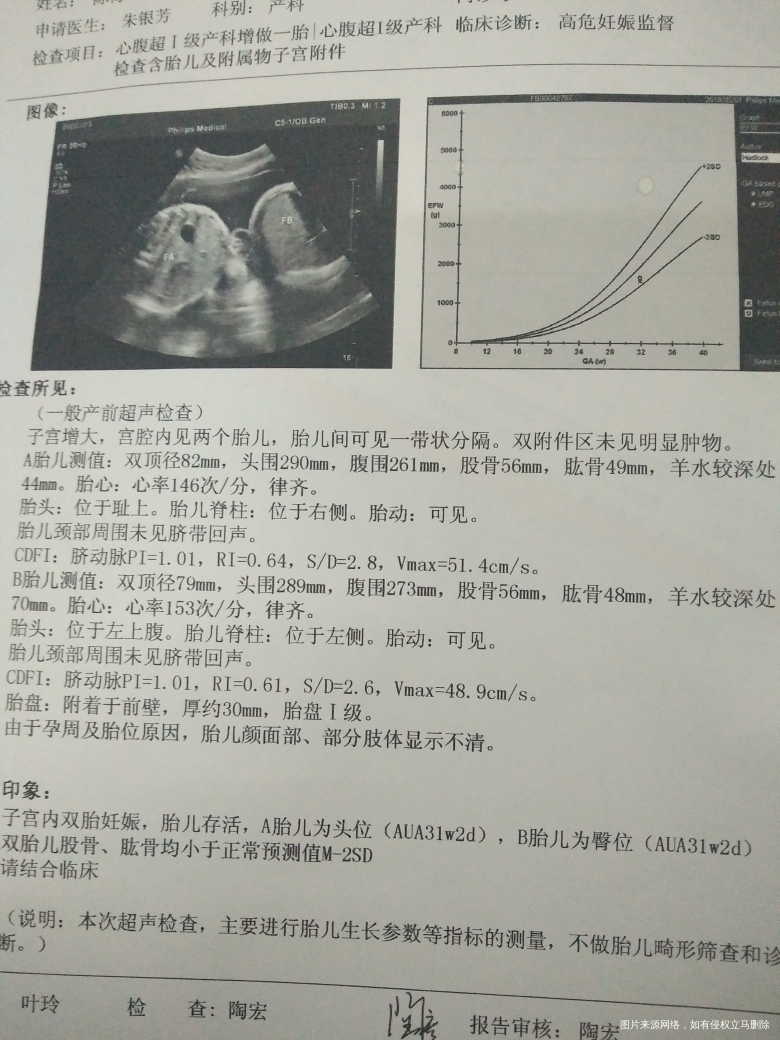 麻烦医生帮忙看看宝宝多重