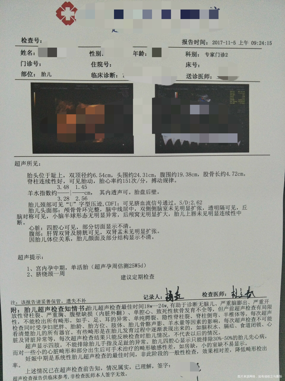 b超单子能看出男女吗