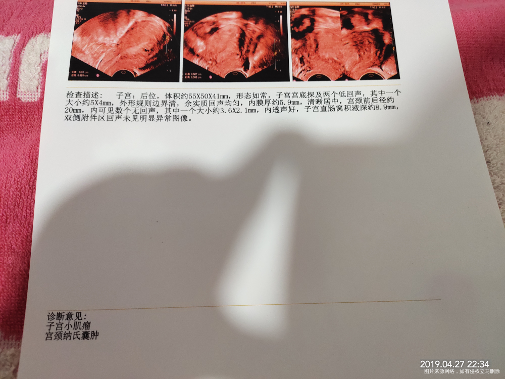 正常的子宫体积,厚度,前后径