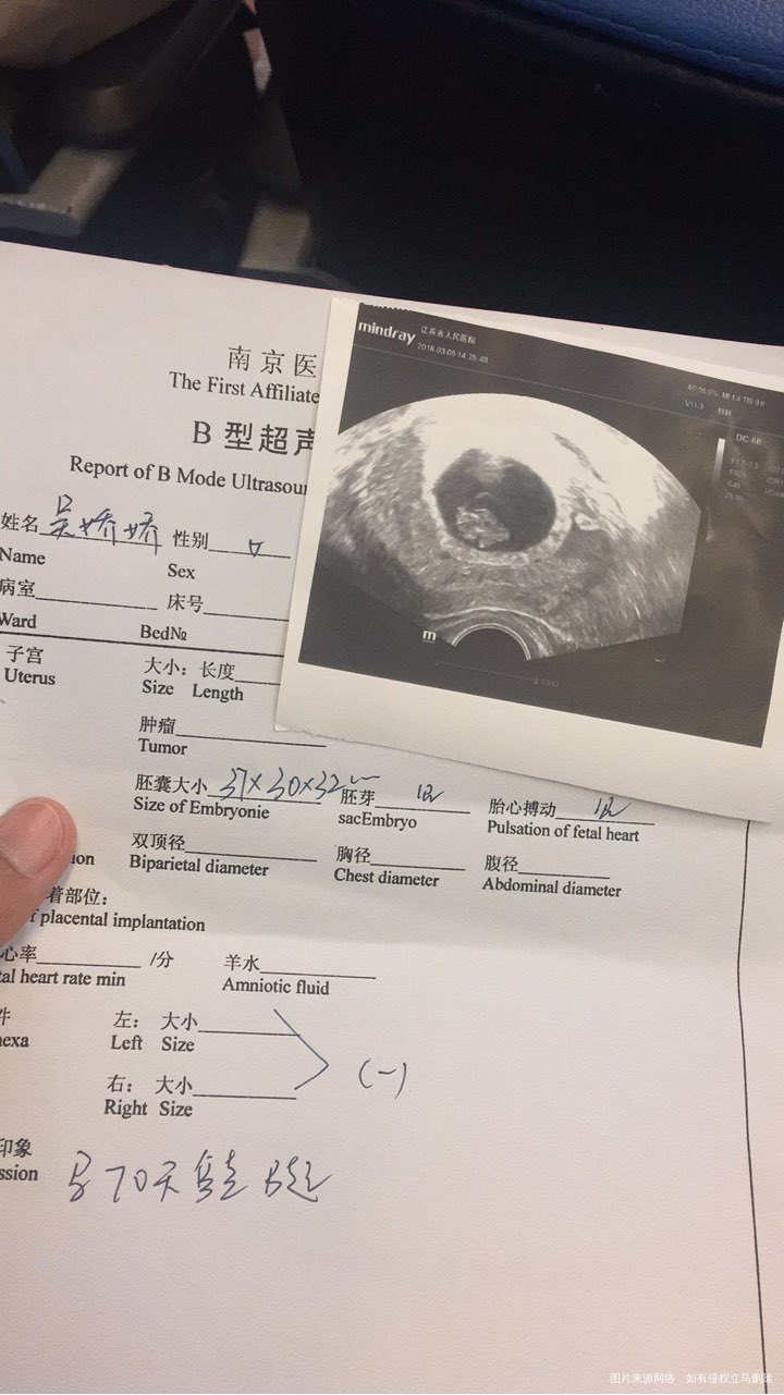 宝贝你好棒 你要继续加油哦!爸爸妈妈都很爱你❤虽然你让妈妈吐的死去活来 但是...