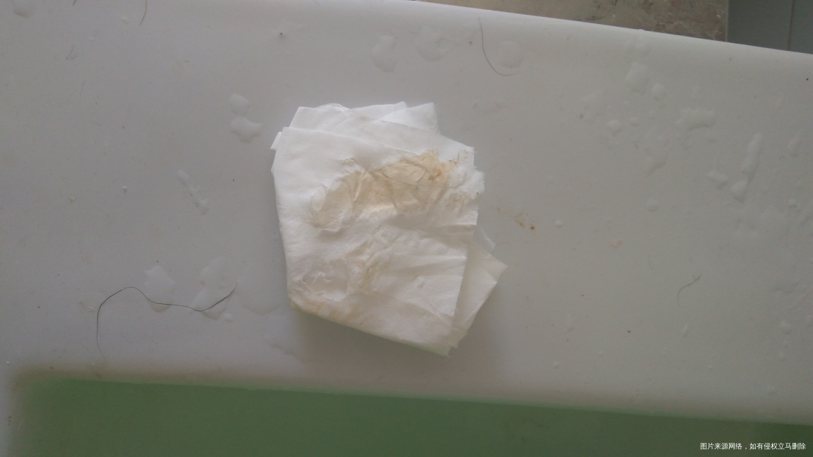 急急急!今天开始有分泌物,麻烦医生看看正常吗