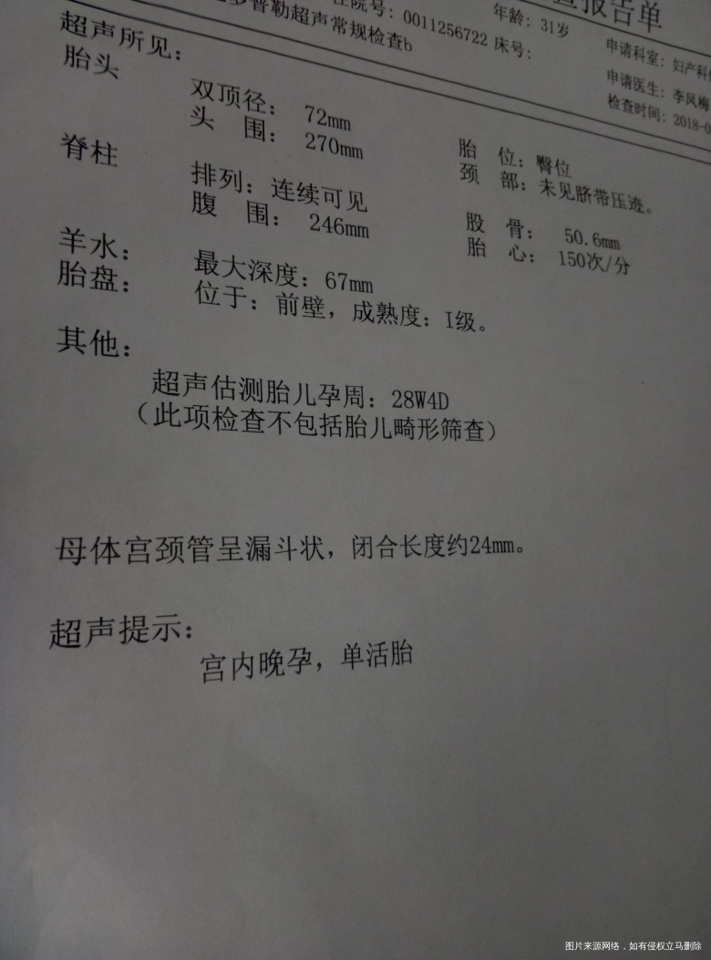 医生帮忙看看这个漏斗状严重么?还有小孩有多重,符合孕周么