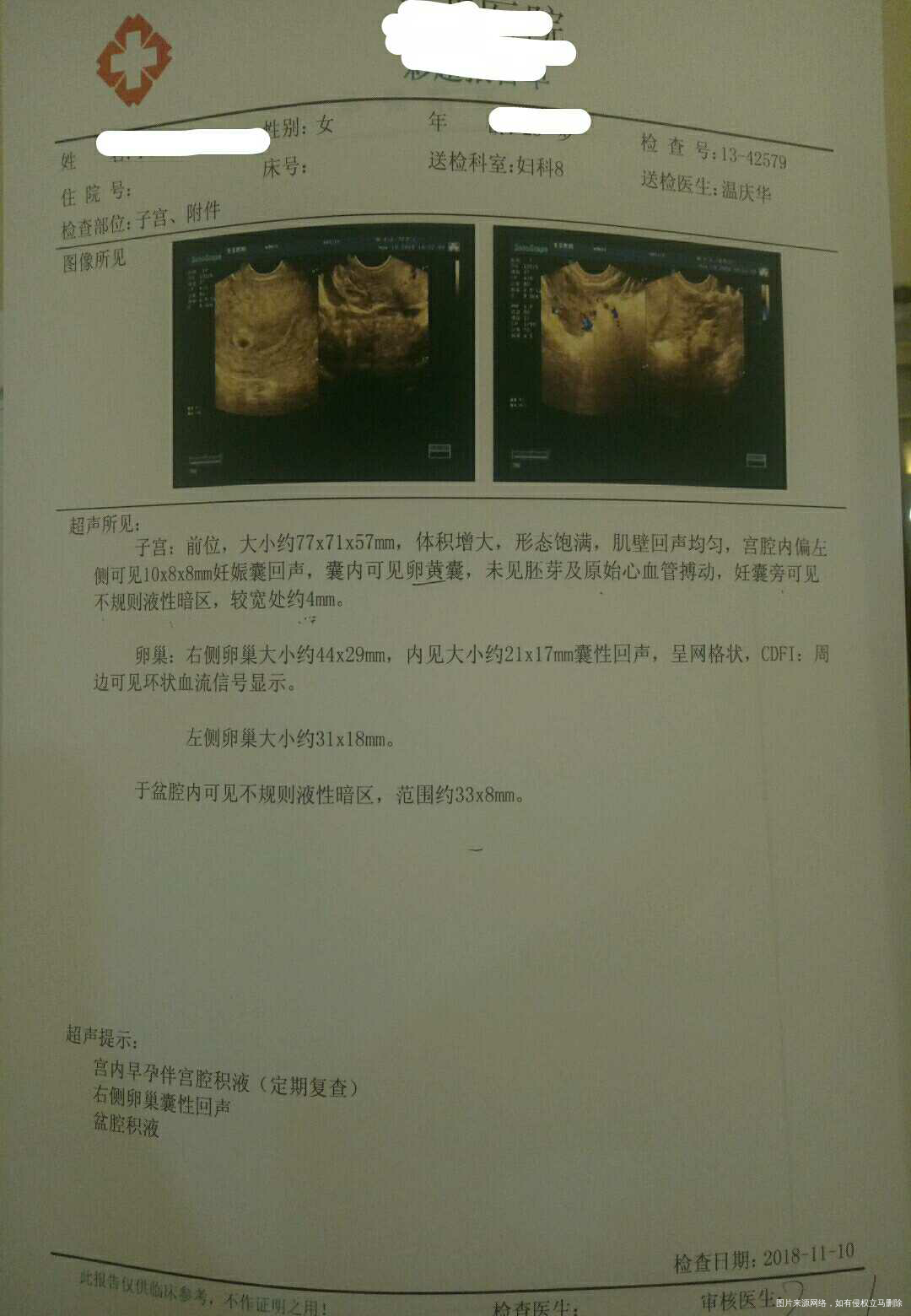 孕早期,而且是这个情况。可以吃花甲吗?