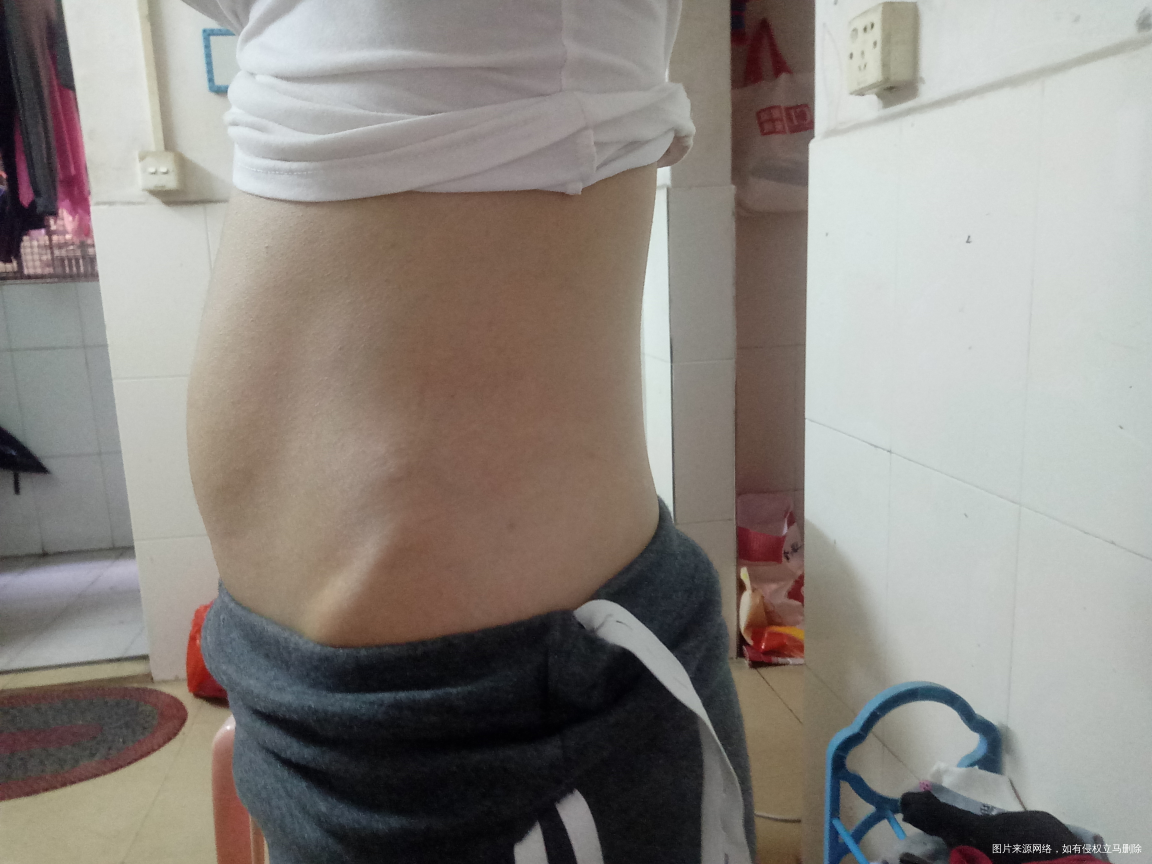 还不够三个月,11周多,肚子真的大了,正常吗?