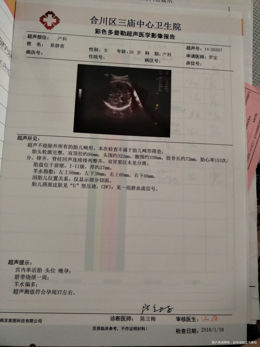 小腹痛,到医院就诊,以为要生了