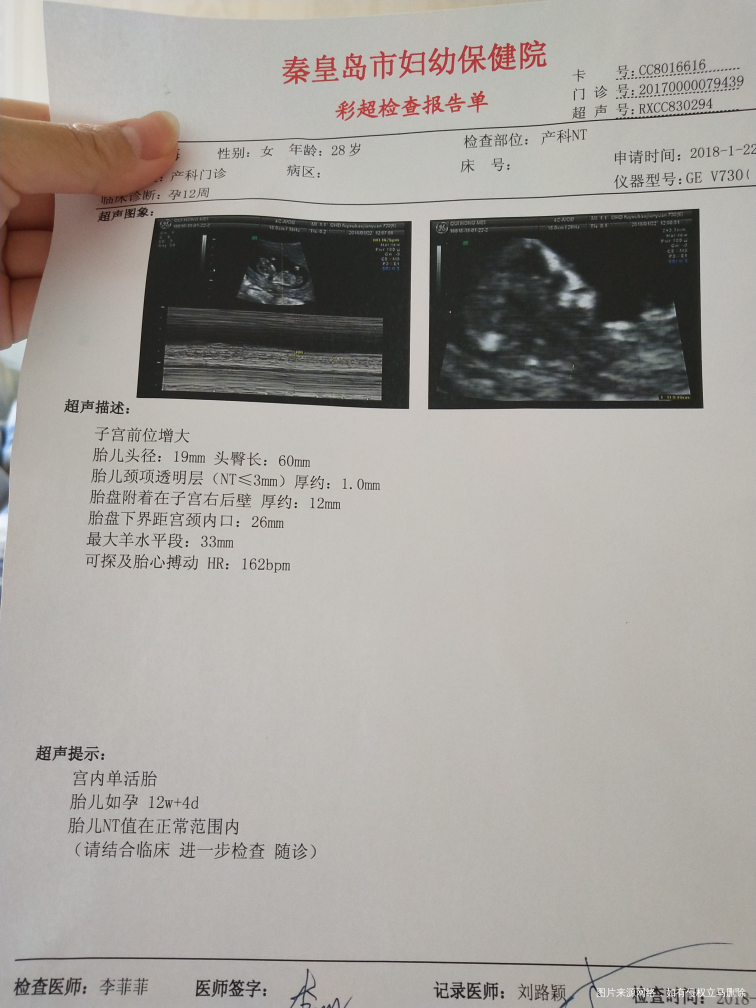 做的NT,帮忙看看像男孩还是女孩