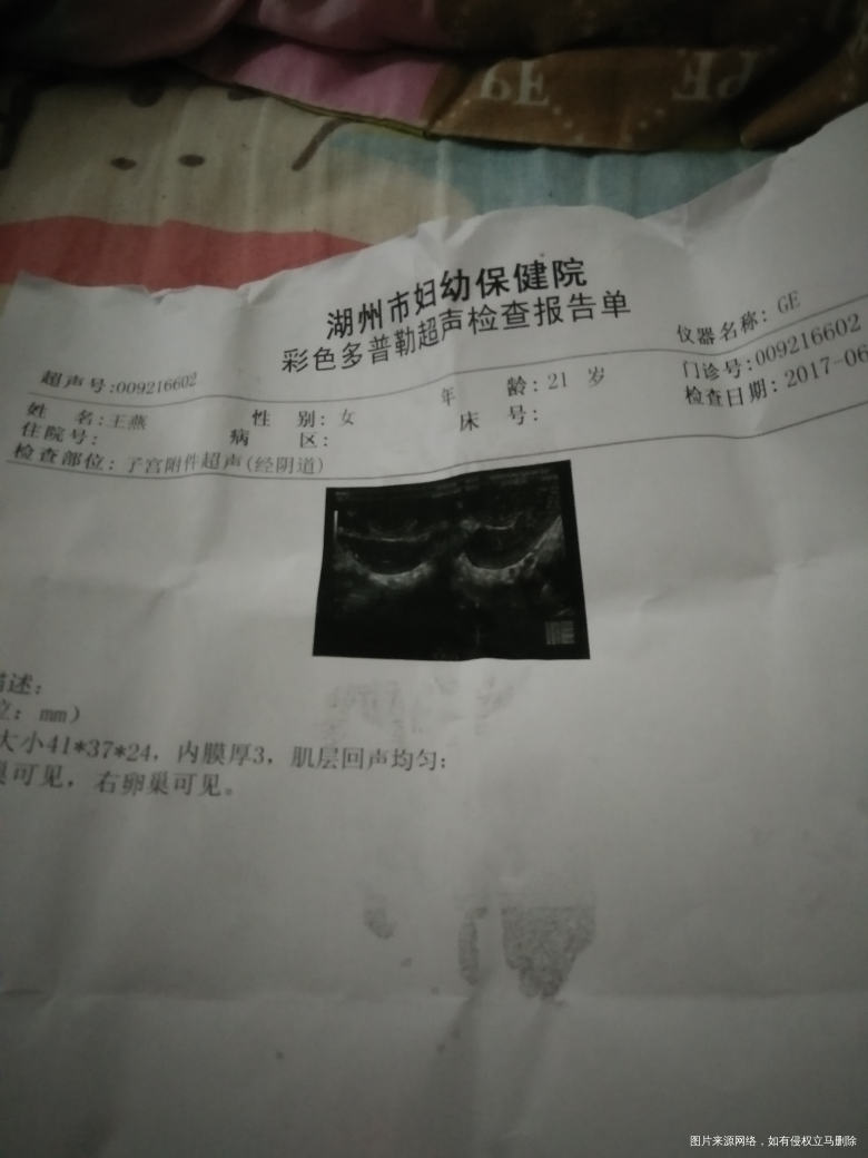 求你们看看是不是正常吗?