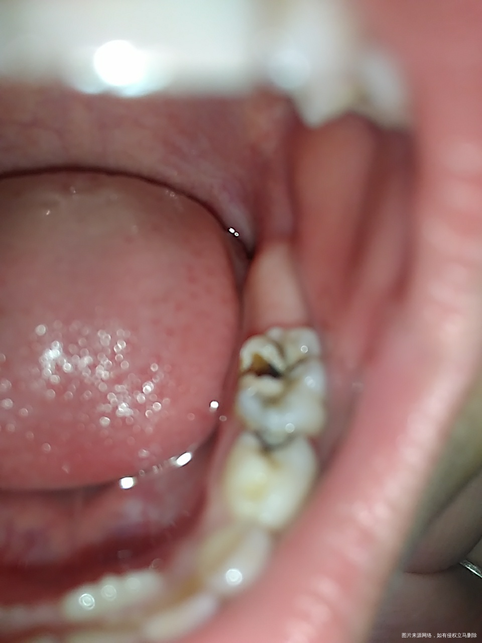 【育儿知识】接触宝贝的第一次换牙