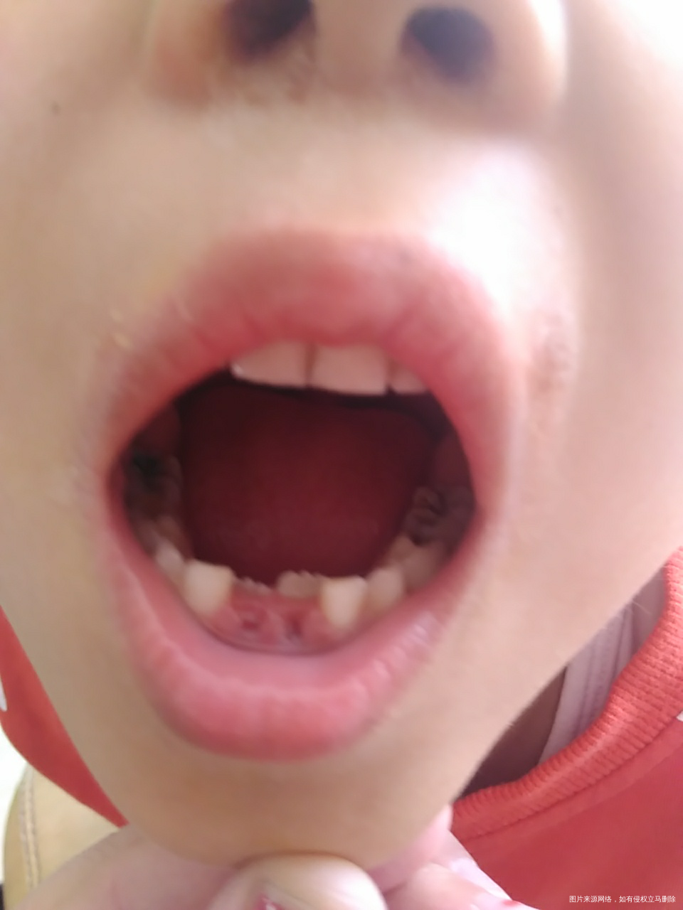 【育儿知识】接触宝贝的第一次换牙