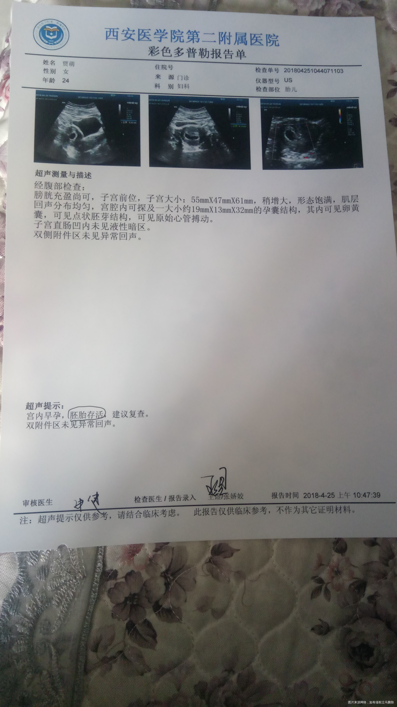 大夫帮忙给看看,现在看胎心胎芽是不是有点早