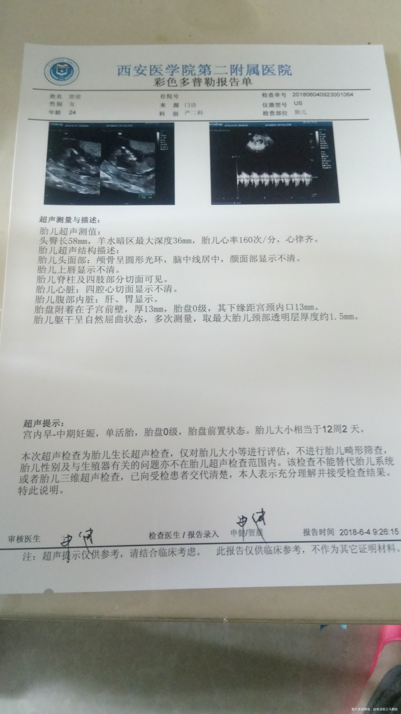 今天做了b超.NT,有些不明白,求医生给看看