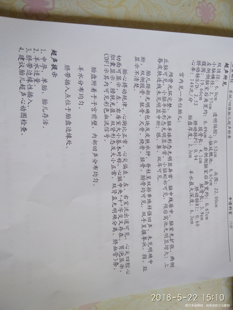 系统/四维胎儿超声检查