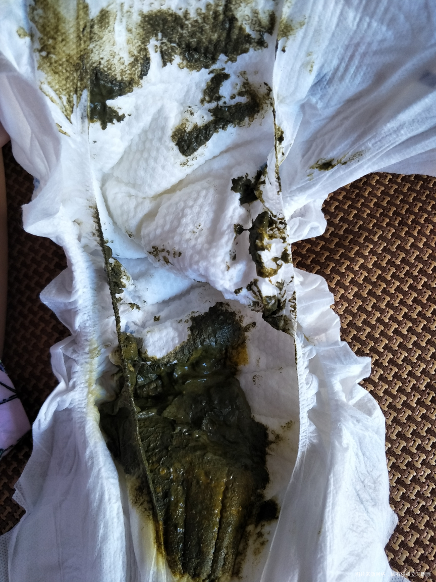 医生能帮我看看吗?谢谢!