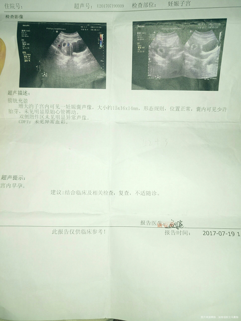 求助医生,记不清末次月经