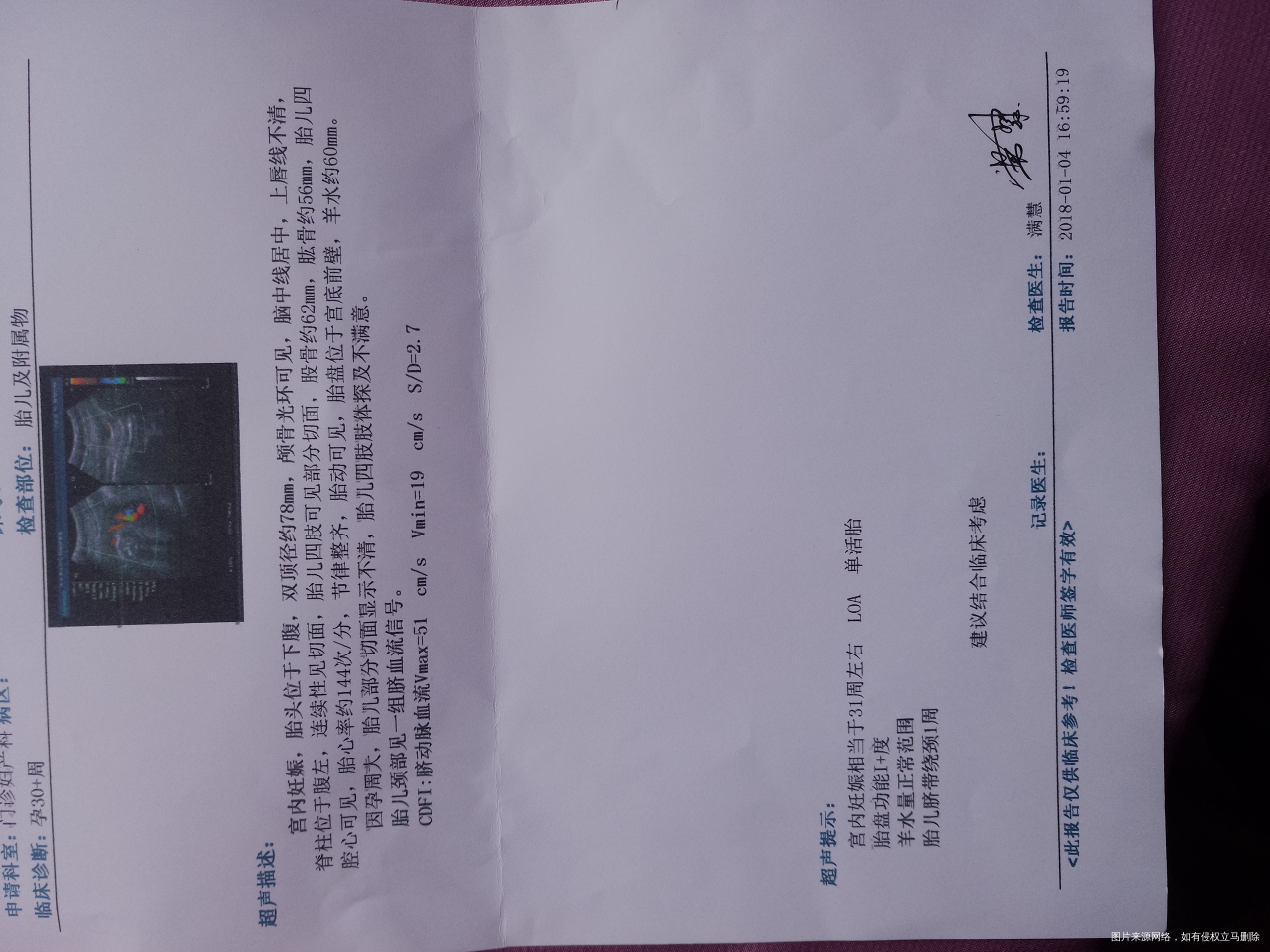 医生帮忙看看b超单,有什么需要注意的