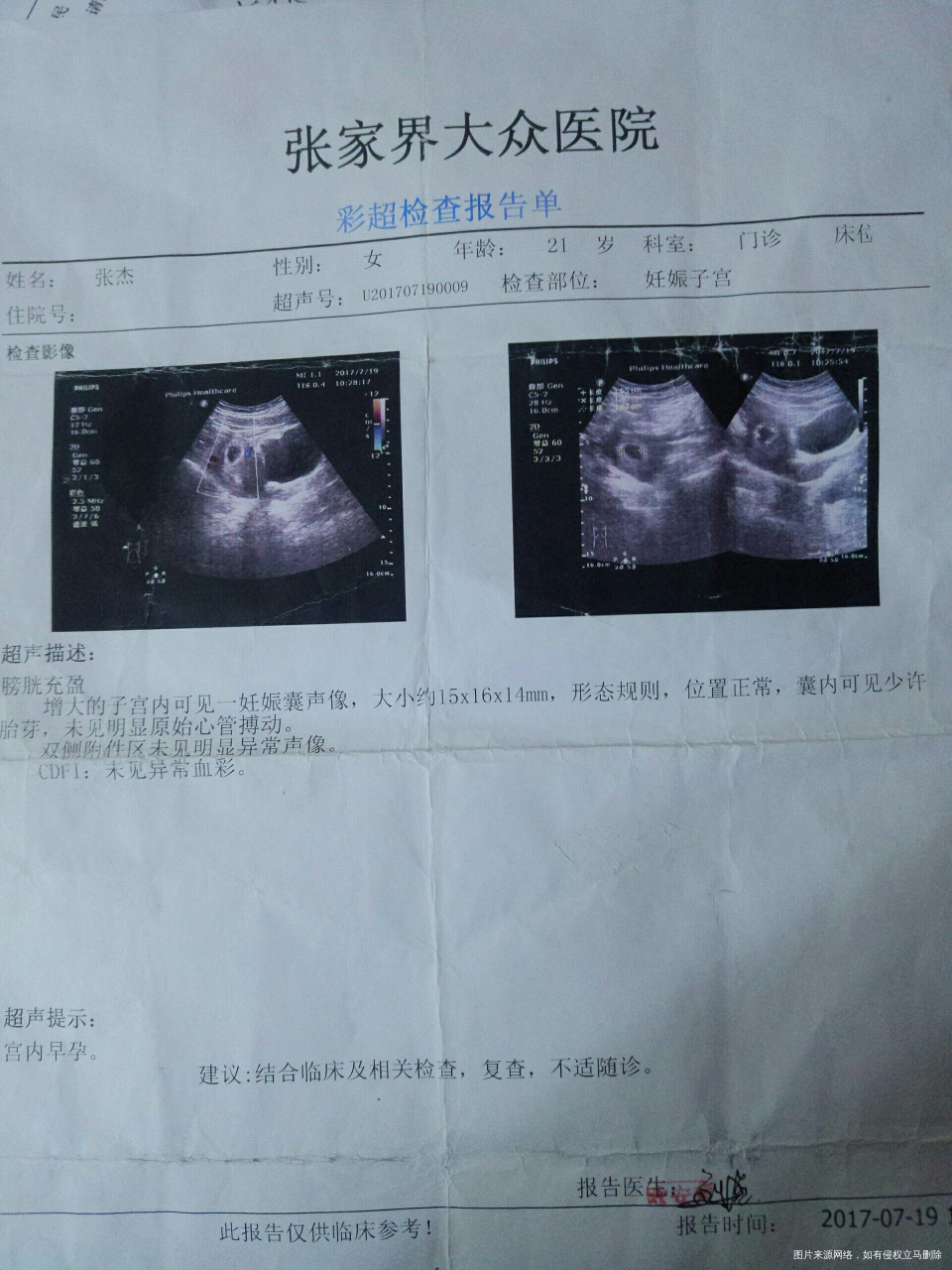 我就是记不清自己末次月经,这几天特别纠结,我怕预产期错,你帮我看看符合几月份怀的