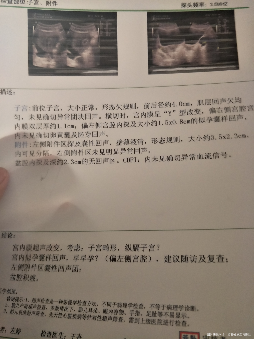 b超结论:子宫畸形,纵隔子宫