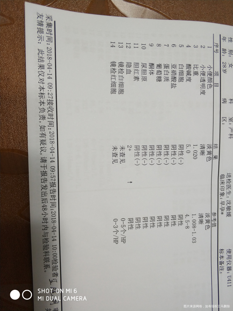 帮我看看这个结果,啥意思