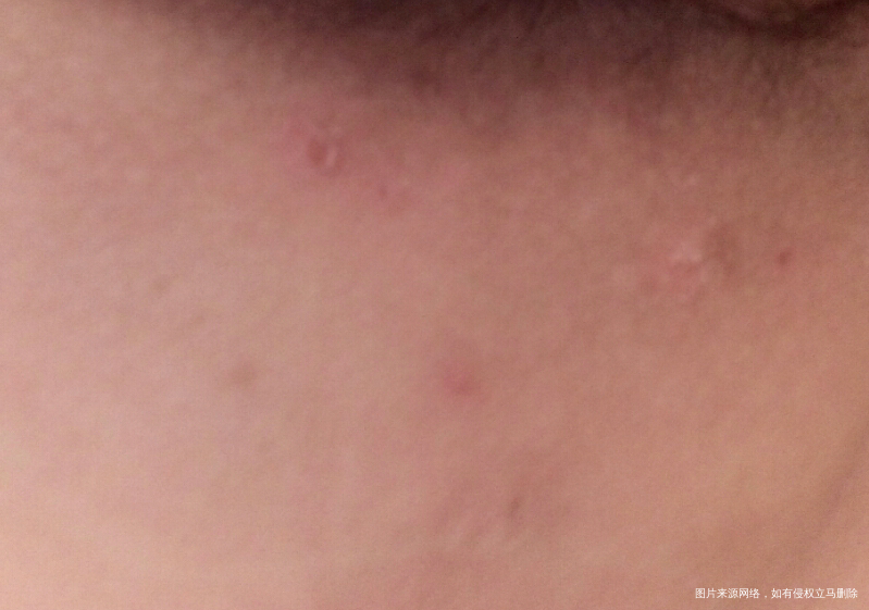 医生帮忙看看这个长的是什么