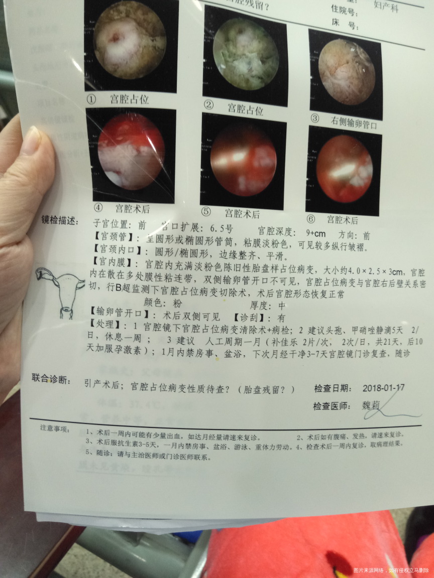 雌激素和孕激素怎么服用