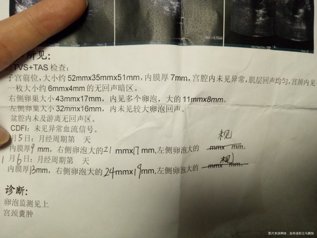 你好,第三次卵泡检测了,没破