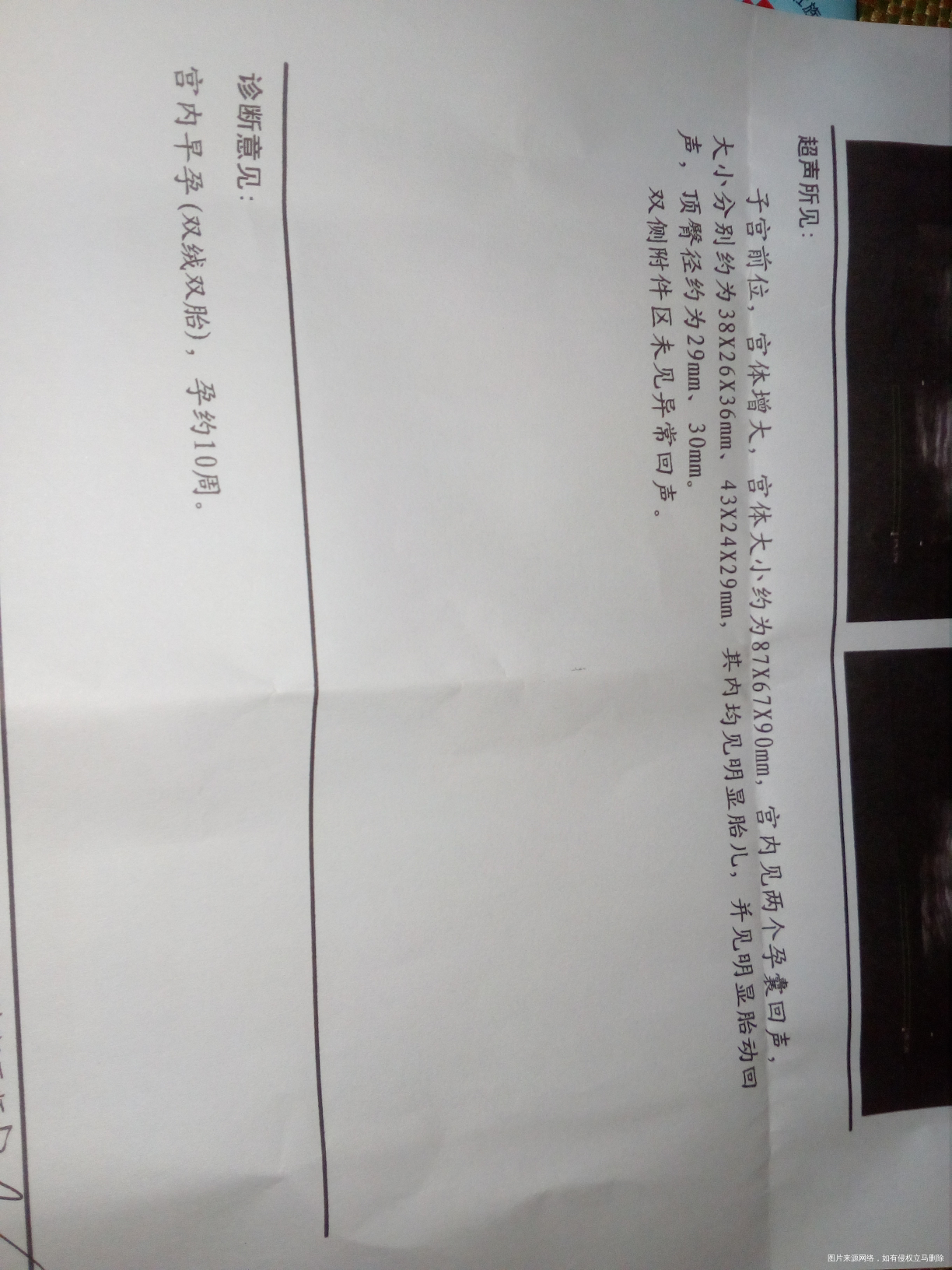 试管婴儿,5.16移植,帮忙看看!