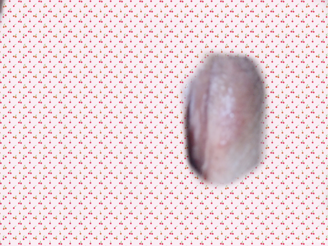 请帮忙看一下我这是怎么了?有图,有点不雅,请见谅。