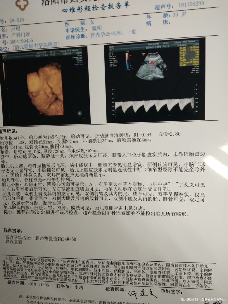 医生帮忙看一下。我的这个四维结果。